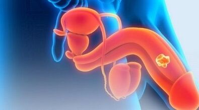 Exercicios para aumentar un membro