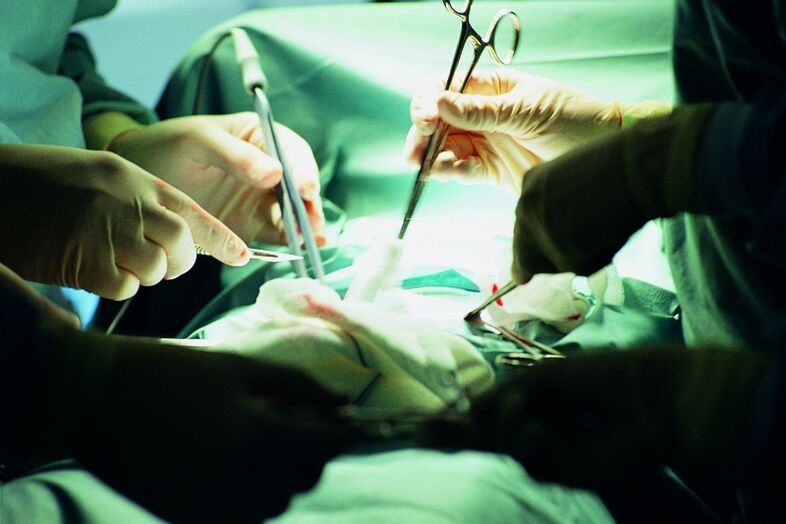 aumento cirúrxico do grosor do pene