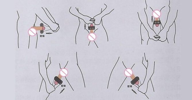 Técnica Jelqing para a ampliación do pene